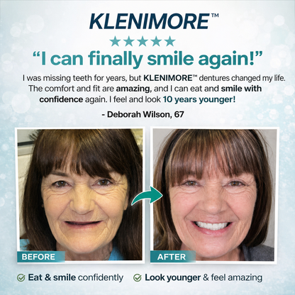 ⏰ 75% OFF Today! KLENIMORE™ Complete Dentures – Natural-Looking Smile
