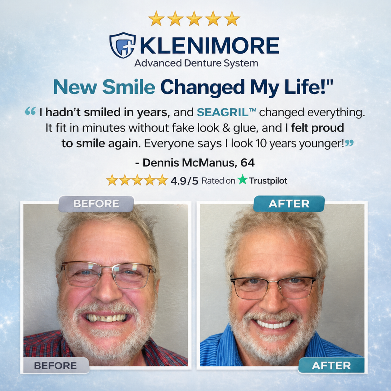 ⏰ 75% OFF Today! KLENIMORE™ Complete Dentures – Natural-Looking Smile